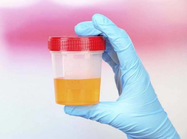 Zwangerschapstest met urine