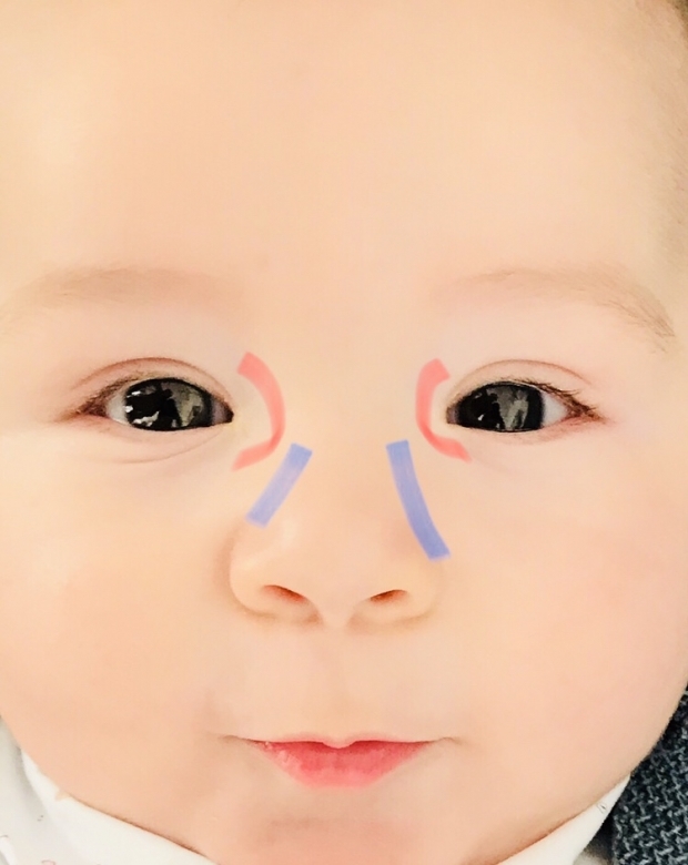 Eye Burr Massage bij baby's