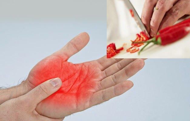 hoe je van peperpijn in de hand afkomt