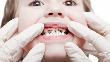 Laat de tandheelkundige zorg van uw kind tijdens het semester doen!