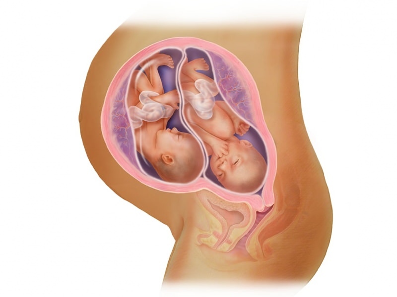 Tweelingzwangerschap bij IVF! Wat is embryotransfer?