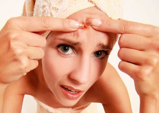 Veroorzaakt acne hoofdpijn? Wat te doen tegen pijnlijke acne? Pijn door acne ...