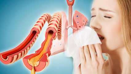 Wat veroorzaakt sputum? Welke ziekten is sputum een ​​voorbode van ziekten? Natuurlijke manieren om sputum te verdrijven ...