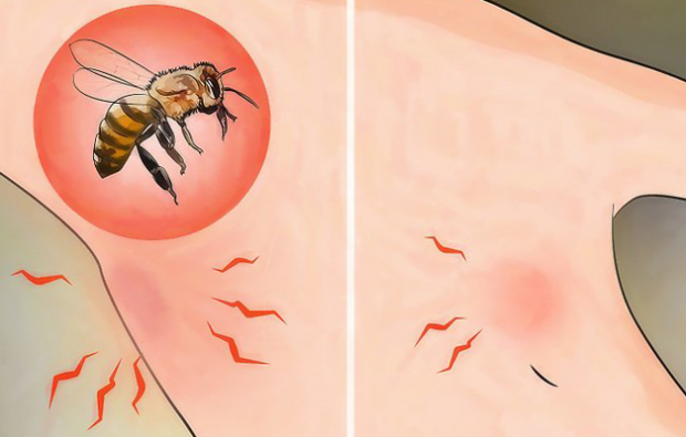 Wat is bijenallergie en wat zijn de symptomen? Natuurlijke methoden die goed zijn voor bijensteken