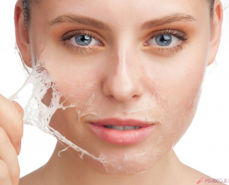 Wat is goed voor peeling van de huid en hoe pelt de huid? Home remedie voor peeling van de huid