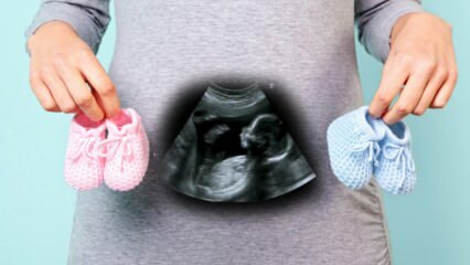Wordt het geslacht van de baby bepaald in het eerste trimester van de zwangerschap?