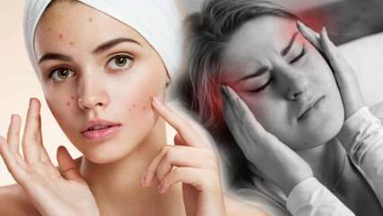 Veroorzaakt acne hoofdpijn? Wat te doen tegen pijnlijke acne? Pijn door acne ...