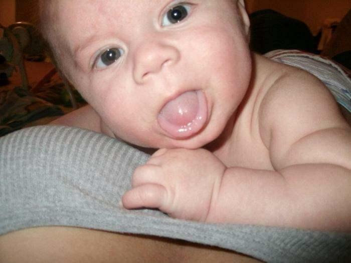 tong uitsteekt bij baby's