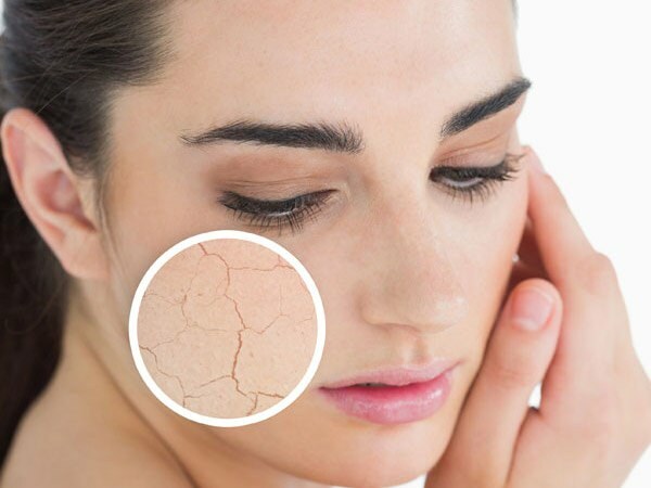 Tips voor droge huidverzorging