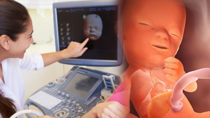 Welk orgaan ontwikkelt zich het eerst bij baby's? Babyontwikkeling week na week