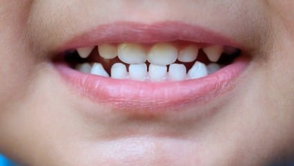 Hoe kinderen tandheelkundige zorg te leren?