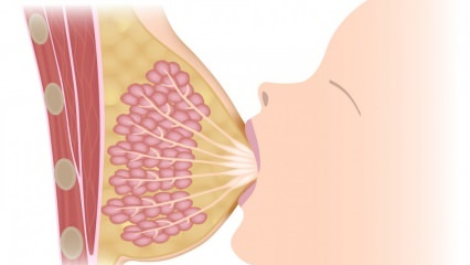 Wat is mastitis (borstontsteking)? Mastitis symptomen en behandeling tijdens borstvoeding