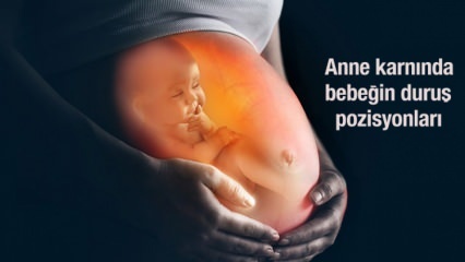 De houdingsposities van de baby in de baarmoeder! Hoe de positie van de baby begrijpen? Naar het geboortekanaal ...