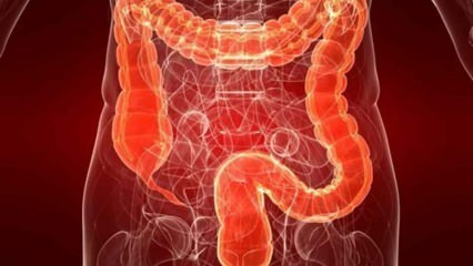 De ziekte die Sezen Aksu al jaren kent! Wat is colitis? Waarom en wat zijn de symptomen?