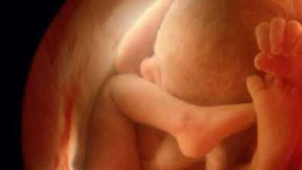 Het geslacht van de baby niet laten zien op echografie! Hoe zien babyjongens en -meisjes eruit op echografie?
