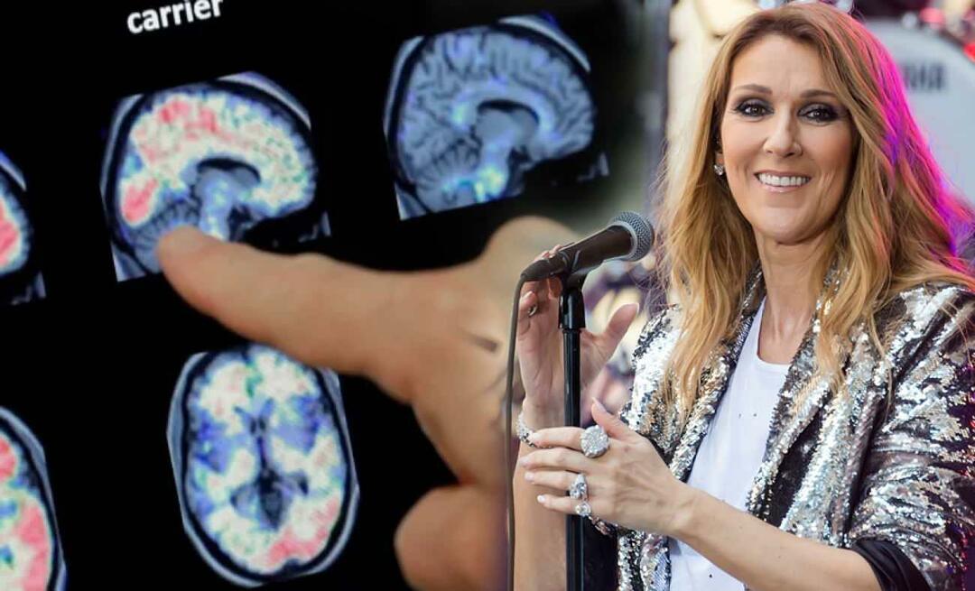Wat is het stijve-persoonsyndroom? Wat is de ziekte van Celine Dion?