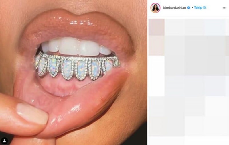 Kim Kardashian's tandheelkundige edelsteen van $ 5.000