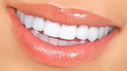 Natuurlijke methoden voor het bleken van tanden