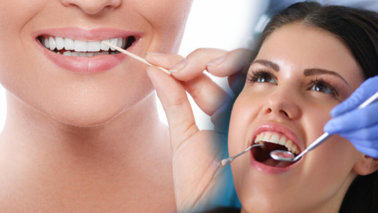 Hoe mond- en tandgezondheid behouden? Waarop moet worden gelet bij het tandenpoetsen?