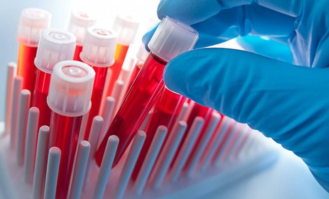 Wat zijn de tekenen van infectie in het bloed? Hoe wordt infectie in het bloed behandeld?