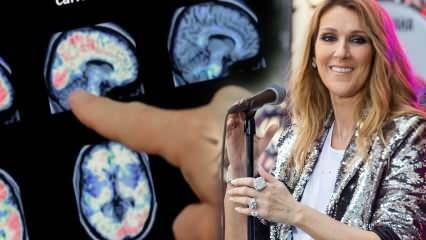 Wat is het stijve-persoon-syndroom? Celine Dion