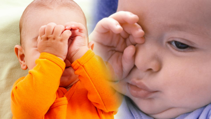 Natuurlijke oplossingen voor oogverbranding bij baby's