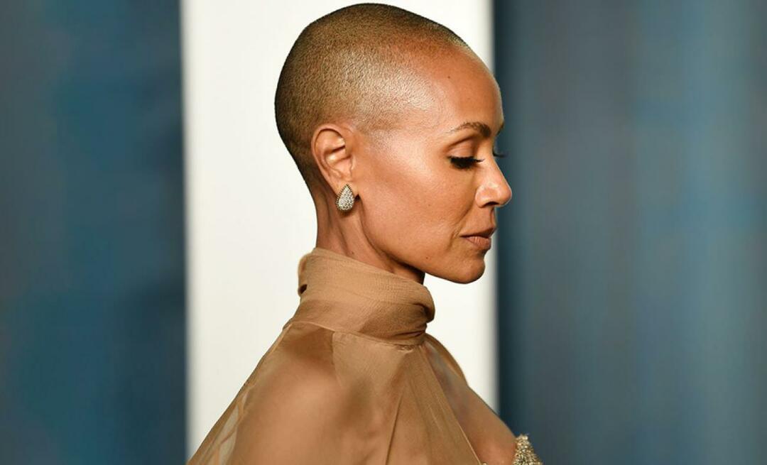 Jada Pinkett Smith, wiens ringworm het onderwerp was van een gesp tijdens de Oscars, verbrak haar stilzwijgen!