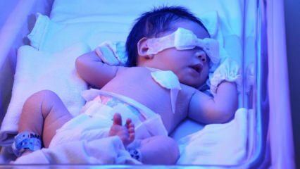 Wat is pasgeboren geelzucht? Hoe gaat geelzucht bij baby's thuis over? Mate van geelzucht bij zuigelingen