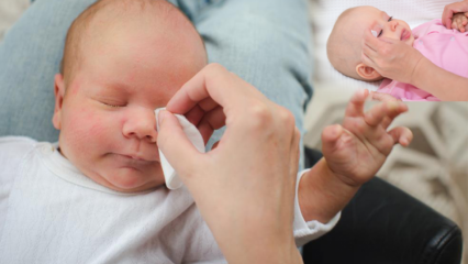 Hoe bramen bij baby's te verwijderen? Veroorzaakt oogbramen bij baby's? Braammassage met moedermelk