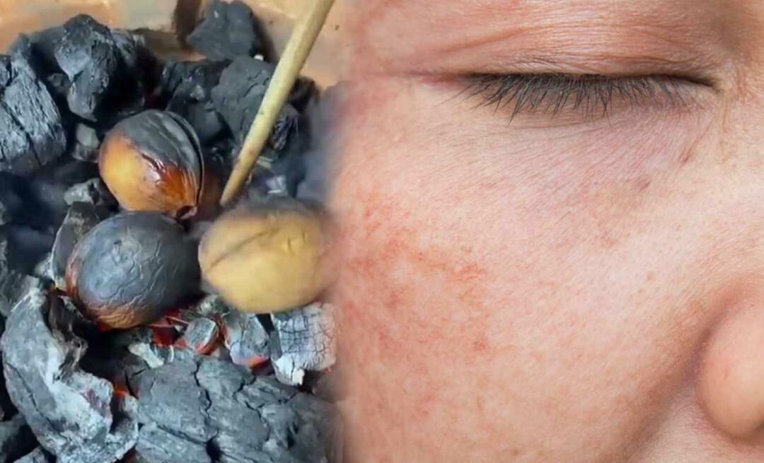 Een walnoot-olijfoliemengsel dat oneffenheden en brandplekken op je gezicht verwijdert met slechts één pen!
