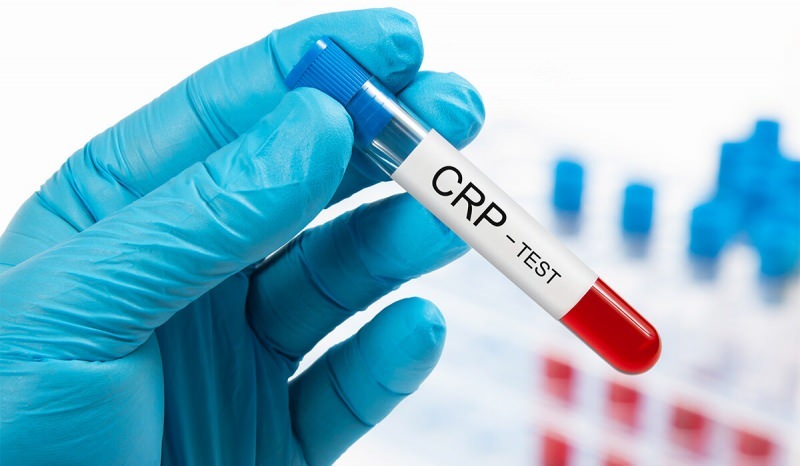 Waarom stijgt CRP in het bloed? Wat is CRP? Hoe de CRP verlagen?