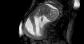 Het duidelijkste beeld van de baby in de baarmoeder verscheen!