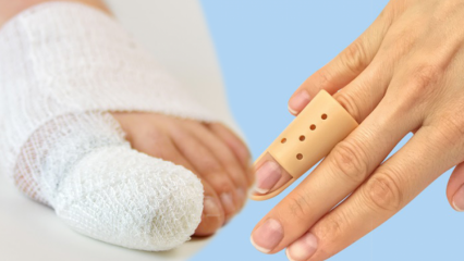 Wat veroorzaakt vingerbreuk? Wat zijn de symptomen van vingerbreuk?