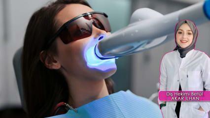 Hoe wordt de methode voor het bleken van tanden (bleken) uitgevoerd? Beschadigt de bleekmethode de tanden?