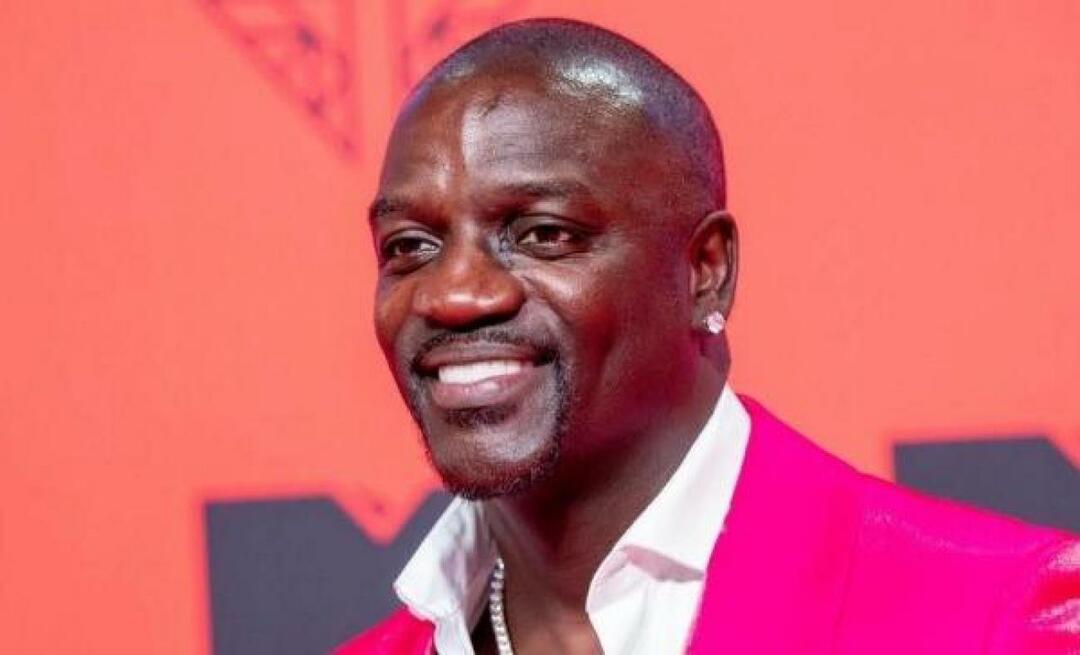 De Amerikaanse zanger Akon gaf ook de voorkeur aan Turkije voor haartransplantatie! Dit is de prijs die hij betaalde...