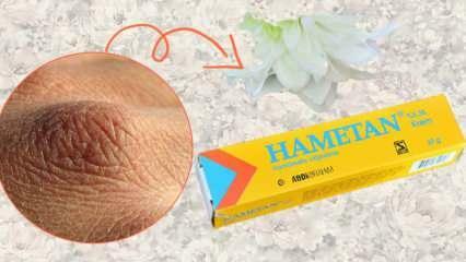 Wat doet Hametan-crème? Hametan creme voor thuisgebruik! Hametan verschillen