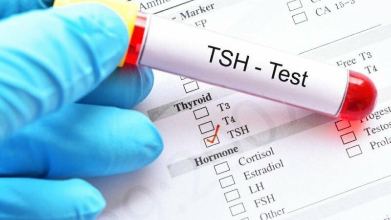 tsh-test is een hormoontest