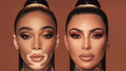 Kim Kardashian en Winnie Harlow werden reclame-gezichten in hetzelfde frame!
