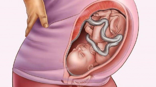 Wat is placenta previa?
