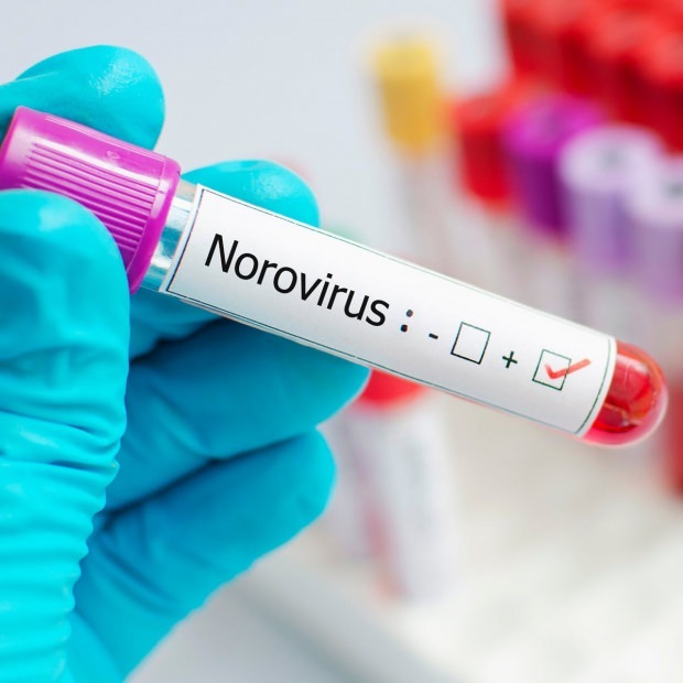 Wat is norovirus en welke ziekten veroorzaken?
