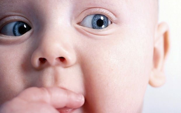 Waarom verschuift de oog bij baby's?