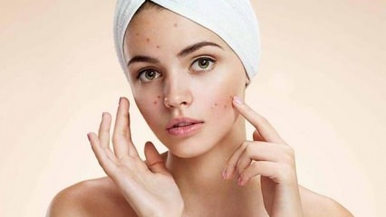 Zijn acnepillen schadelijk?