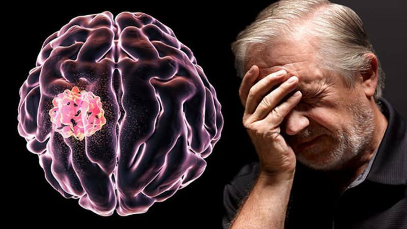 Het weefsel dat in de hersenen wordt gevormd door de verstoring van celstructuren, wordt een tumor genoemd.
