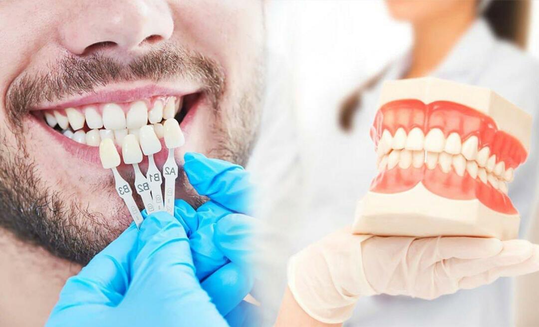Waarom worden zirkoniumkronen op tanden aangebracht? Hoe duurzaam is de zirkoniumcoating?