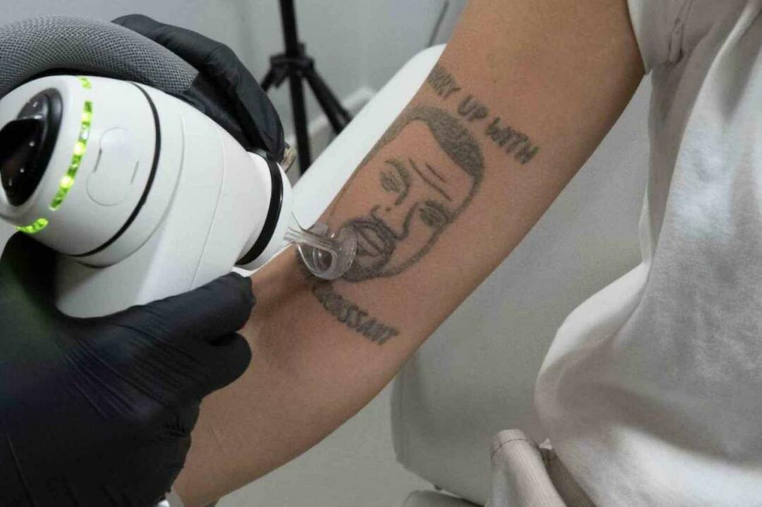 Kanye West-tatoeage wordt gratis verwijderd in Londen 