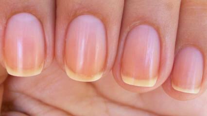 Waarom wordt de nagel geel? Hoe maak je nagels wit die geel worden van nagellak?