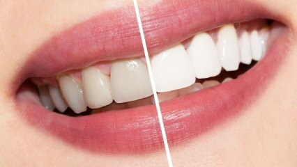 Wat zijn de aanbevelingen voor witte tanden? Natuurlijk bleken van tanden thuis genezen ...