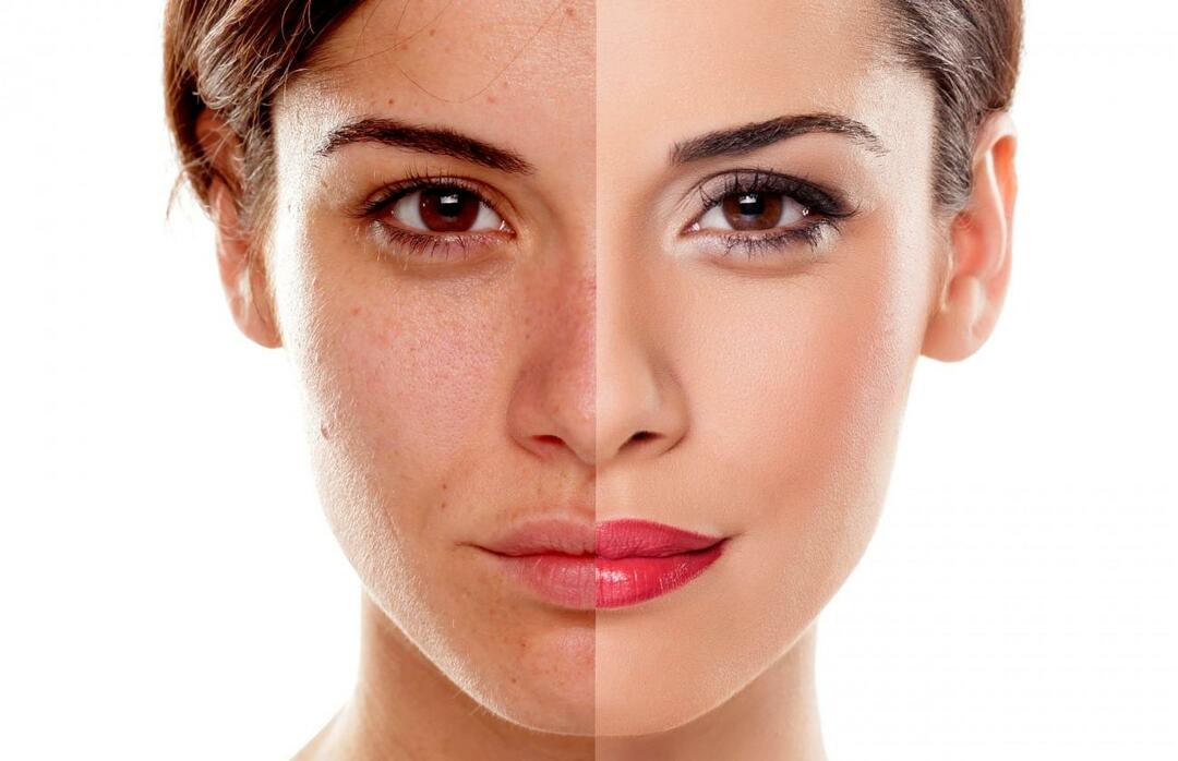 Hoe voorkomen we dat de huid er vermoeid uitziet? Hoe kan ik het vermoeide uiterlijk van de huid verminderen?