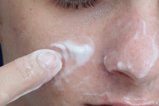 Hoe passeren gaten en putjes in het gezicht? Wat veroorzaakt een gaatje in het gezicht?