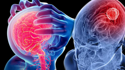 Wat is degeneratie van het cerebellum (ruggenmerg)? Wat zijn de symptomen van het cerebellum (ruggenmerg)?